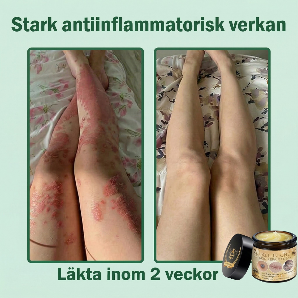 Dermaluxe™ – Multi-Action Bigift Anti-Aging Hudkräm
