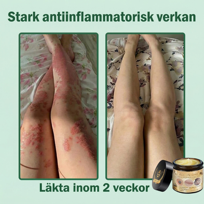 Dermaluxe™ – Multi-Action Bigift Anti-Aging Hudkräm