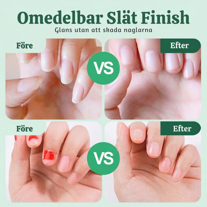 TrimEase™ – Portabel Automatisk Nagelklippare