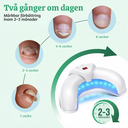 NailRevive™ – Avancerad 3-i-1 Nagelbehandlings Ljusenhet