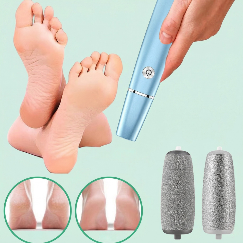 PediPro™ – Uppladdningsbar Elektrisk Pedikyr-förhårdnadsborttagare