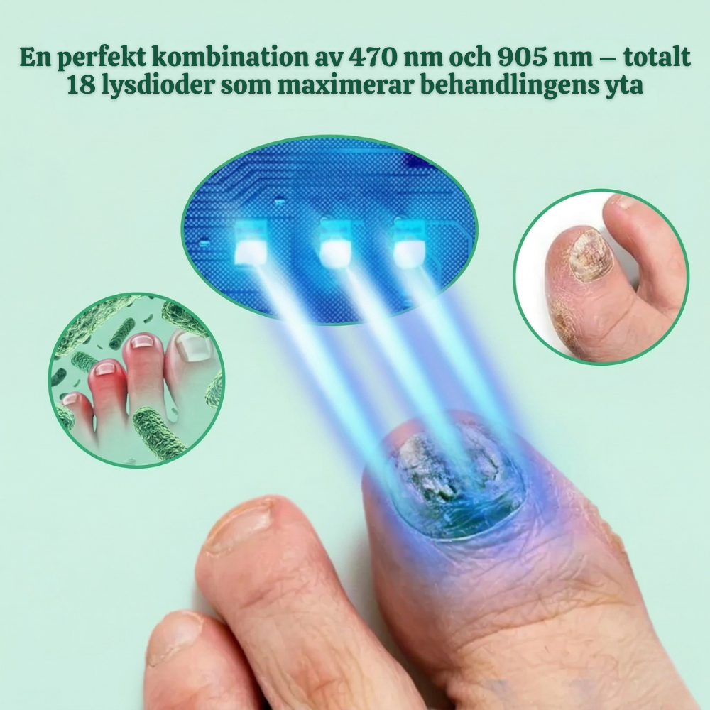NailRevive™ – Avancerad 3-i-1 Nagelbehandlings Ljusenhet