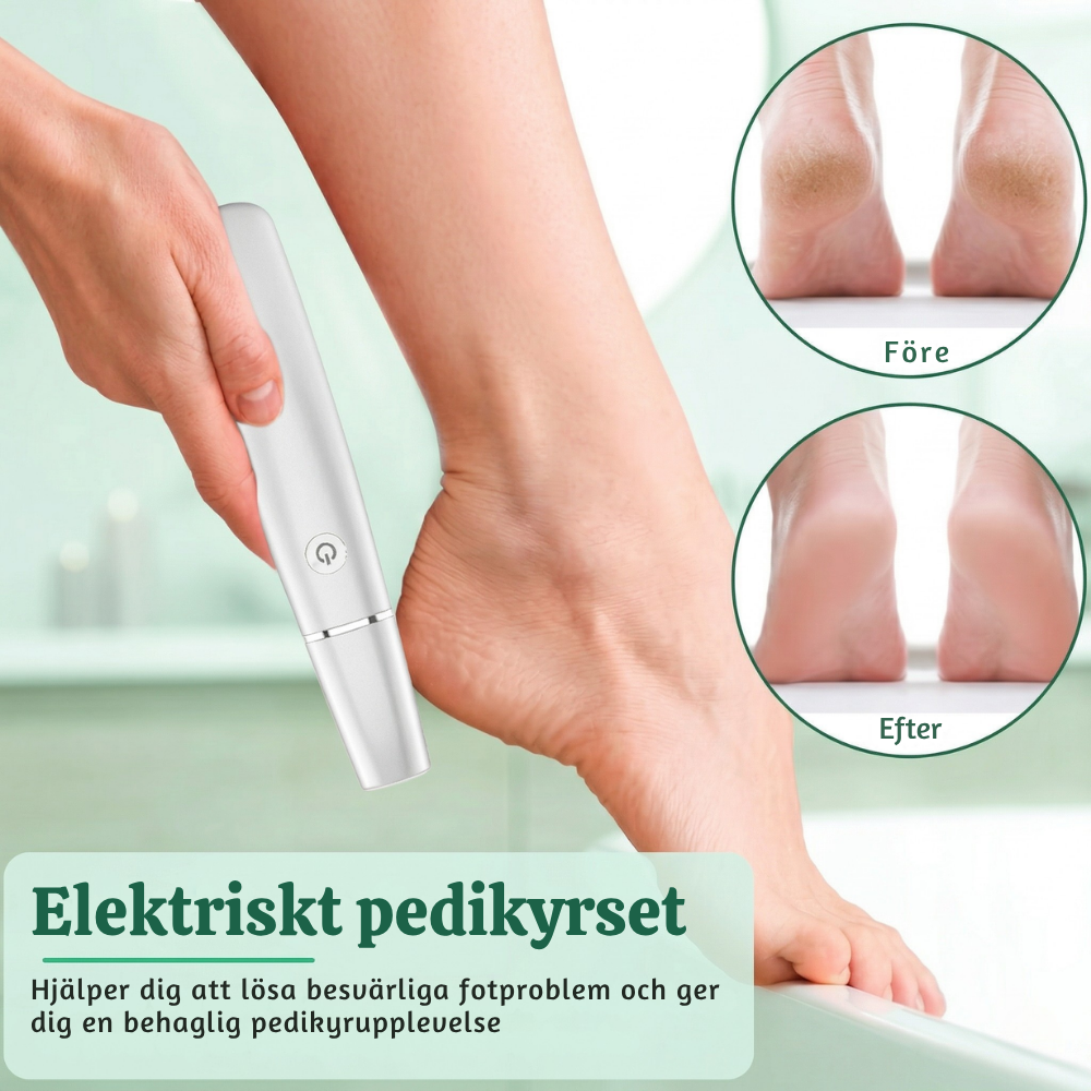 PediPro™ – Uppladdningsbar Elektrisk Pedikyr-förhårdnadsborttagare