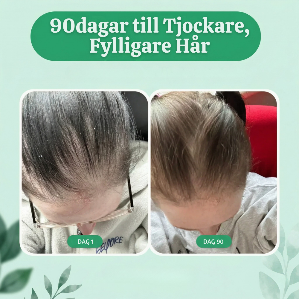 Follicra™ – Pumpafröolja Hårstöd Softgels