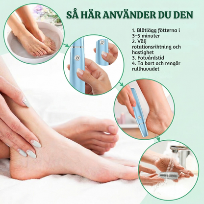 PediPro™ – Uppladdningsbar Elektrisk Pedikyr-förhårdnadsborttagare